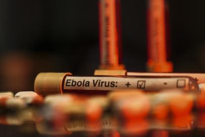 ABD'den Ebola uyarısı: Tarihin en ölümcül seviyesine ulaşabilir
