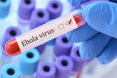 Afrika’da Ebola salgını büyüyor