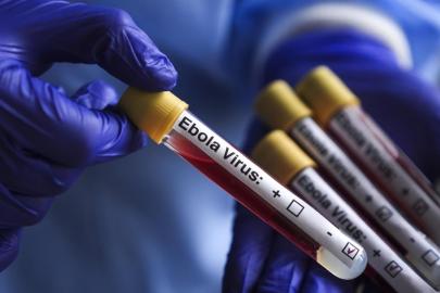 Fransa'da Ebola vakası görüldü