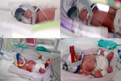 Avustralya’da tek yumurta dördüzleri dünyaya geldi 